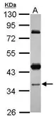 Anti-CCDC94 antibody [N2C3] used in Western Blot (WB). GTX120394