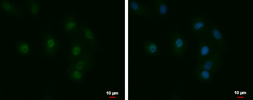 Anti-LCMT1 antibody used in Immunocytochemistry/ Immunofluorescence (ICC/IF). GTX120404