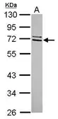 Anti-CCDC67 antibody [C1C3] used in Western Blot (WB). GTX120422