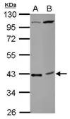Anti-C18orf54 antibody [N1C1] used in Western Blot (WB). GTX120432