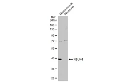 Anti-NSUN4 antibody [N1C2] used in Western Blot (WB). GTX120442