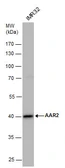 Anti-AAR2 antibody used in Western Blot (WB). GTX120448