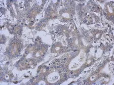 Anti-FUZ antibody [N2C3] used in IHC (Paraffin sections) (IHC-P). GTX120464