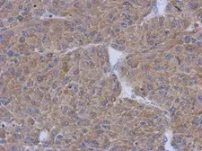 Anti-CCDC17 antibody [N3C2], Internal used in IHC (Paraffin sections) (IHC-P). GTX120475