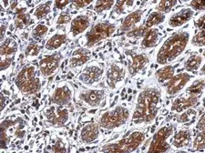Anti-PSG3 antibody used in IHC (Paraffin sections) (IHC-P). GTX120476