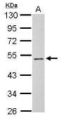 Anti-PSG3 antibody used in Western Blot (WB). GTX120476