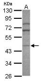 Anti-AP1M2 antibody [N3C3] used in Western Blot (WB). GTX120477