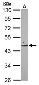 Anti-SMCR7 antibody [C1C3] used in Western Blot (WB). GTX120484