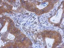 Anti-WDR85 antibody [N3C3] used in IHC (Paraffin sections) (IHC-P). GTX120495