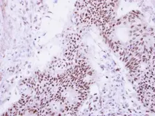 Anti-DDX47 antibody used in IHC (Paraffin sections) (IHC-P). GTX120497