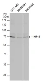 Anti-KIF12 antibody used in Western Blot (WB). GTX120529
