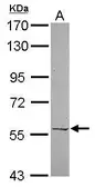 Anti-PRPF4 antibody [N3C3] used in Western Blot (WB). GTX120537