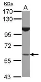 Anti-BTBD16 antibody [N1C1] used in Western Blot (WB). GTX120539