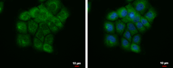 Anti-SELB antibody used in Immunocytochemistry/ Immunofluorescence (ICC/IF). GTX120560