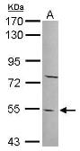 Anti-PYROXD2 antibody [N2C2], Internal used in Western Blot (WB). GTX120562