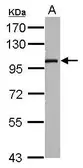 Anti-SLC9A8 antibody used in Western Blot (WB). GTX120569