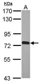 Anti-ZNF417 antibody [N1C1] used in Western Blot (WB). GTX120572