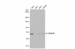 Anti-KLHL21 antibody [C1C3] used in Western Blot (WB). GTX120580