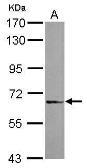 Anti-DDX59 antibody [N3C2], Internal used in Western Blot (WB). GTX120592