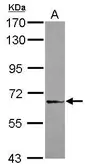 Anti-DDX59 antibody [N3C2], Internal used in Western Blot (WB). GTX120592