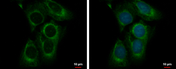 Anti-CEP70 antibody used in Immunocytochemistry/ Immunofluorescence (ICC/IF). GTX120594