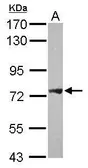 Anti-PLA2G4F antibody [C2C3], C-term used in Western Blot (WB). GTX120597