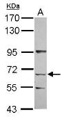 Anti-KLHL13 antibody [N1N2], N-term used in Western Blot (WB). GTX120610