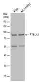 Anti-TTLL12 antibody [C1C3] used in Western Blot (WB). GTX120613