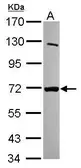 Anti-MTMR8 antibody [C1C3] used in Western Blot (WB). GTX120628