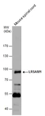Anti-LRSAM1 antibody used in Western Blot (WB). GTX120647