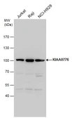 Anti-KIAA0776 antibody used in Western Blot (WB). GTX120661