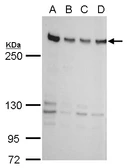 Anti-ZNF638 antibody used in Western Blot (WB). GTX120667