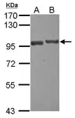 Anti-USP6NL antibody [N1N2], N-term used in Western Blot (WB). GTX120672