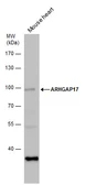 Anti-ARHGAP17 antibody used in Western Blot (WB). GTX120680