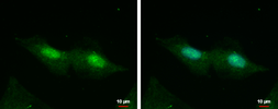Anti-CXorf57 antibody used in Immunocytochemistry/ Immunofluorescence (ICC/IF). GTX120687