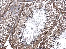 Anti-CNTROB antibody used in IHC (Paraffin sections) (IHC-P). GTX120691
