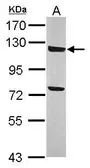 Anti-ANKLE2 antibody [N1N3] used in Western Blot (WB). GTX120698