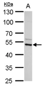 Anti-ADC antibody [N2C2], Internal used in Western Blot (WB). GTX120705