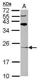 Anti-ARL8A antibody [N1C3] used in Western Blot (WB). GTX120723