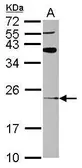 Anti-ARL8A antibody [N1C3] used in Western Blot (WB). GTX120723