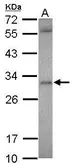 Anti-ASB12 antibody [N1C3] used in Western Blot (WB). GTX120729