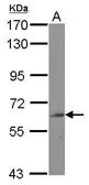 Anti-BIN2 antibody [N1N3] used in Western Blot (WB). GTX120736