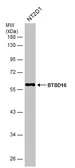 Anti-BTBD16 antibody used in Western Blot (WB). GTX120740
