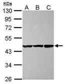 Anti-CBWD1 antibody [N2C3] used in Western Blot (WB). GTX120748