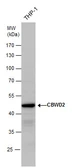 Anti-CBWD2 antibody used in Western Blot (WB). GTX120749