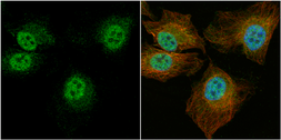 Anti-CCDC14 antibody [C2C3], C-term used in Immunocytochemistry/ Immunofluorescence (ICC/IF). GTX120754