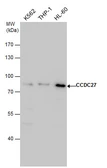 Anti-CCDC27 antibody used in Western Blot (WB). GTX120758