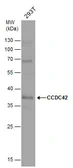 Anti-CCDC42 antibody used in Western Blot (WB). GTX120759