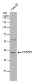 Anti-CCDC92 antibody used in Western Blot (WB). GTX120767