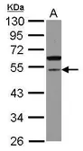 Anti-CDCA7L antibody [N3C3] used in Western Blot (WB). GTX120769